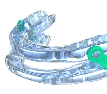 Clear oral appliance tray