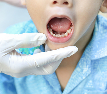 Dentist examining a child's teeth